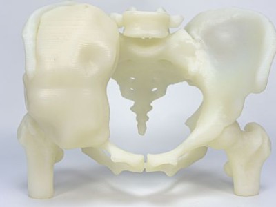3D打印手术模型图1