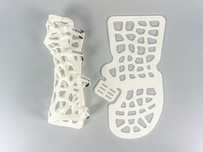 3D打印匹配式支具图1