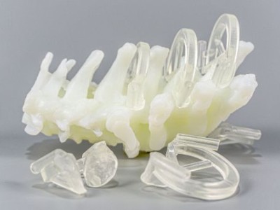 3D打印个性化导板图1