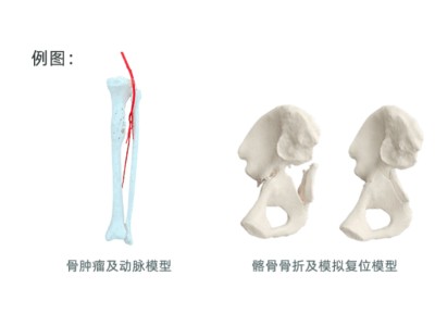 手术辅助模型图1