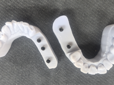 3D树脂牙模图1