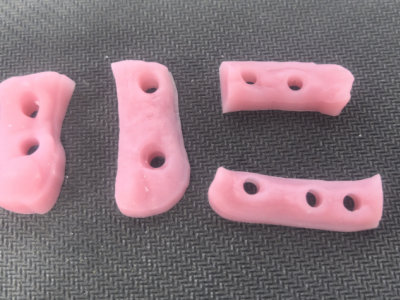 3D打印牙龈图1