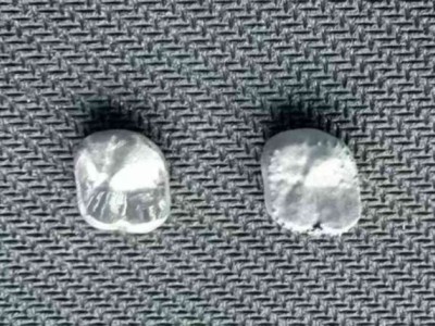 3D打印纯钛冠图1