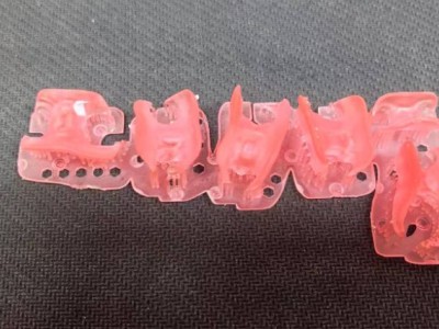 3D打印隐形胶托图1
