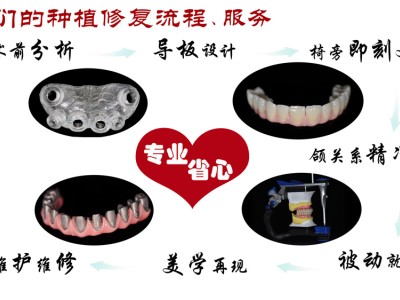 我们的种植修复流程、服务图1