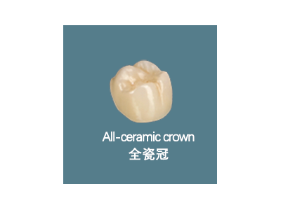 All-ceramic crown 全瓷冠图1