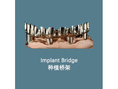 Implant Bridge 种植桥架图1