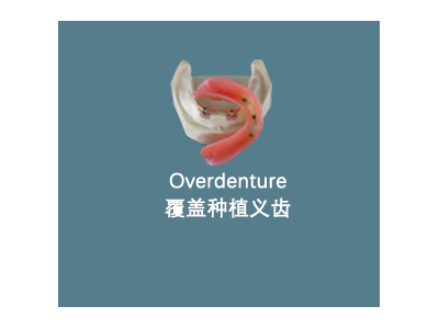 Overdenture 覆盖种植义齿图1