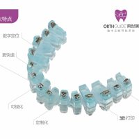 奥世美-数字正畸导航系统