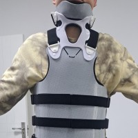 3D打印颈胸腰骶支具