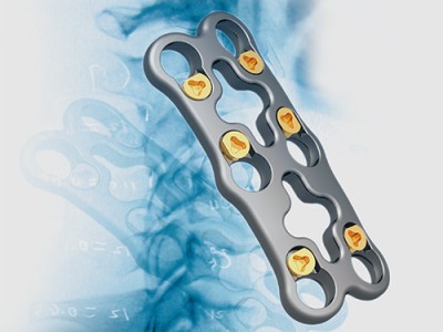 Cervilock ii 颈椎前路钢板系统图1